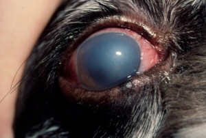 Glaukoma tek qeni